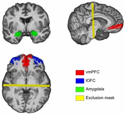 The Inverse Relationship between the Microstructural Variability of Amygdala-Prefrontal Pathways and Trait Anxiety Is Moderated by Sex